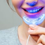 Do Teeth Whitening Gadgets Really Works? Learn the Honest Truth
