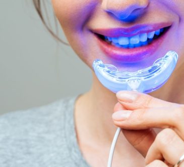 Do Teeth Whitening Gadgets Really Works? Learn the Honest Truth